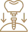 Dental Bridges